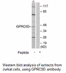 Product image for GPRC5D Antibody