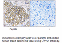 Product image for LPHN2 Antibody