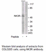 Product image for NK3R Antibody