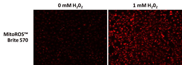 The fluorescence response of MitoROS™ Brite 570 (5 µM) to varying concentrations of H2O2 in HeLa cells was investigated. Fluorescence intensities were measured using a fluorescence microscope equipped with a Cy3 filter.
