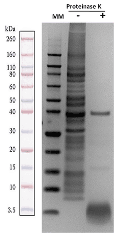 Bacterial lysate, prepared using the ReadiPrep™ Lipopolysaccharide (LPS) Isolation Kit, was boiled at 85 °C for 3-5 minutes in 1X loading buffer. The sample was then loaded onto a 4-12% SDS-PAGE gel and run for 70 minutes at 110V. Afterward, the gel was stained with Coomassie Blue to visualize the proteins.