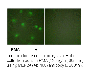 Product image for MEF2A (Ab-408) Antibody