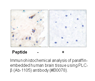 Product image for PLCB3 (Ab-1105) Antibody