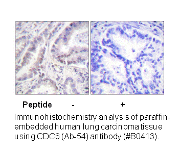 Product image for CDC6 (Ab-54) Antibody