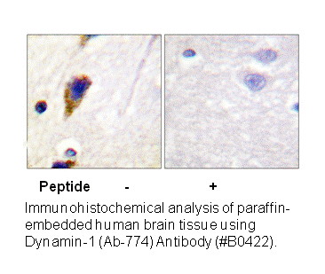 Product image for Dynamin-1 (Ab-774) Antibody