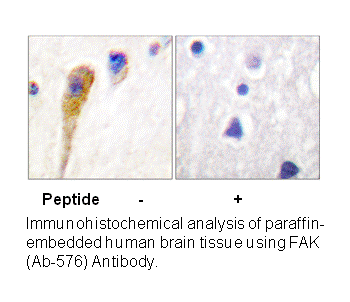 Product image for FAK (Ab-576) Antibody