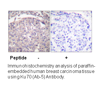 Product image for Ku70 (Ab-5) Antibody