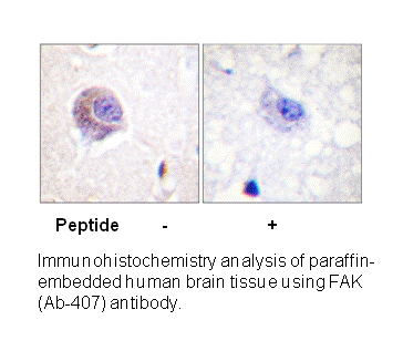 Product image for FAK (Ab-407) Antibody