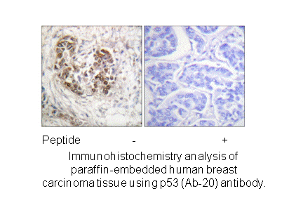 Product image for p53 (Ab-20) Antibody