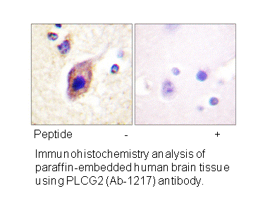 Product image for PLCG2 (Ab-1217) Antibody