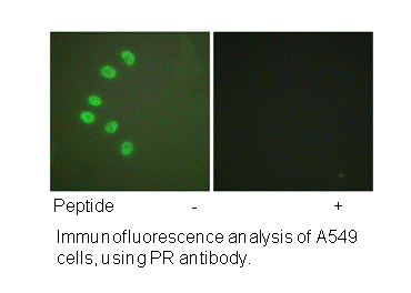 Product image for Progesterone Receptor (Ab-294) Antibody