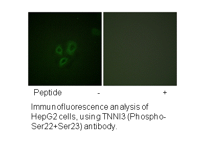 Product image for TNNI3 (Ab-22/23) Antibody