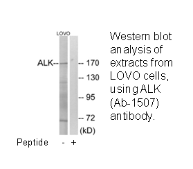 Product image for ALK (Ab-1507) Antibody