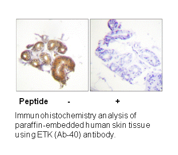 Product image for ETK (Ab-40) Antibody