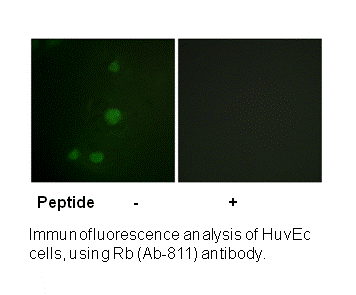 Product image for Retinoblastoma (Ab-811) Antibody