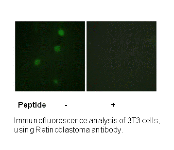 Product image for Retinoblastoma (Ab-821) Antibody