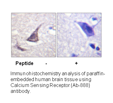 Product image for Calcium Sensing Receptor (Ab-888) Antibody