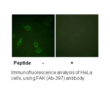 Product image for FAK (Ab-397) Antibody