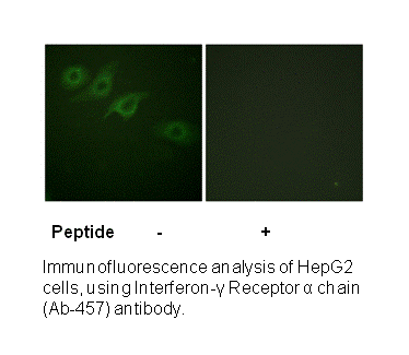 Product image for Interferon-&gamma; Receptor &alpha; chain (Ab-457) Antibody