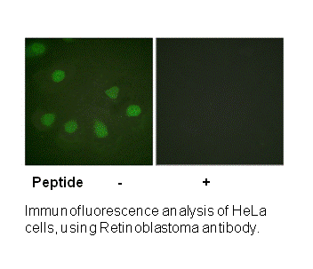 Product image for Retinoblastoma (Ab-249) Antibody