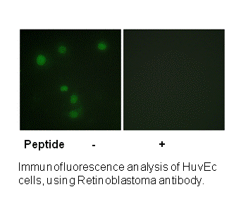 Product image for Retinoblastoma (Ab-826) Antibody