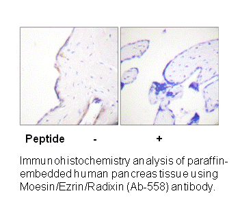 Product image for Moesin (Ab-558) Antibody