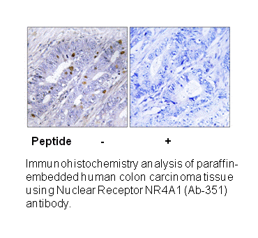 Product image for Nuclear Receptor NR4A1 (Ab-351) Antibody