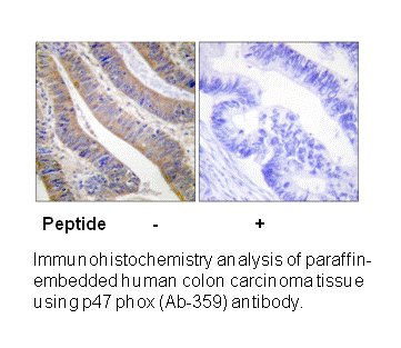 Product image for p47 phox (Ab-359) Antibody