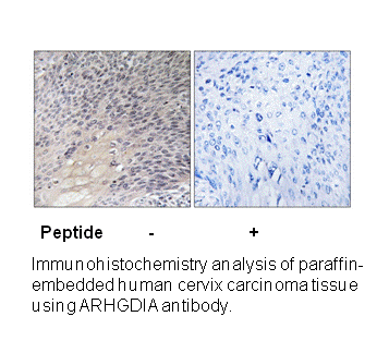 Product image for ARHGDIA (Ab-174) Antibody