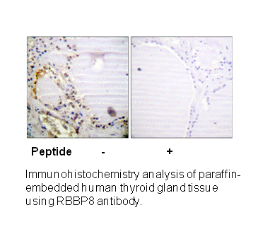 Product image for RBBP8 (Ab-664) Antibody