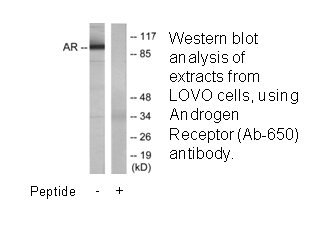 Product image for Androgen Receptor (Ab-650) Antibody