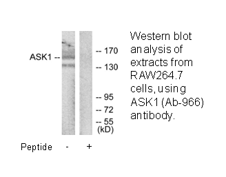 Product image for ASK1 (Ab-966) Antibody