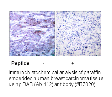 Product image for BAD (Ab-112) Antibody