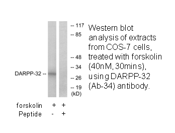 Product image for DARPP-32 (Ab-34) Antibody