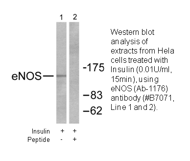 Product image for eNOS (Ab-1176) Antibody