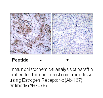 Product image for Estrogen Receptor-&alpha; (Ab-167) Antibody