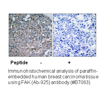 Product image for FAK (Ab-925) Antibody