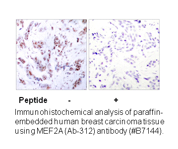 Product image for MEF2A (Ab-312) Antibody