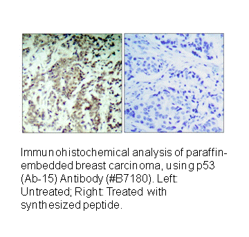 Product image for p53 (Ab-15) Antibody