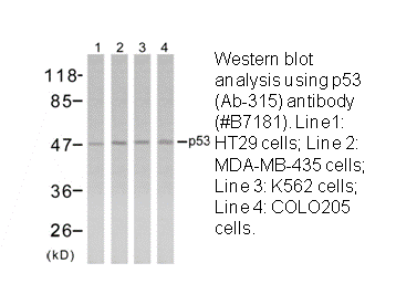 Product image for p53 (Ab-315) Antibody