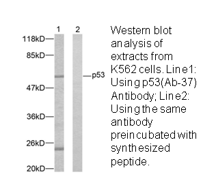 Product image for p53 (Ab-37) Antibody