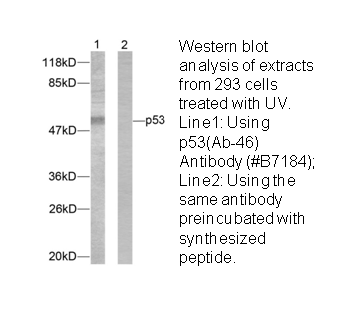 Product image for p53 (Ab-46) Antibody