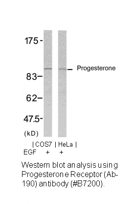 Product image for Progesterone Receptor (Ab-190) Antibody