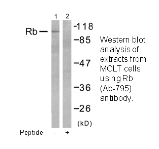 Product image for Retinoblastoma (Ab-795) Antibody