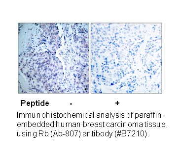 Product image for Retinoblastoma (Ab-807) Antibody