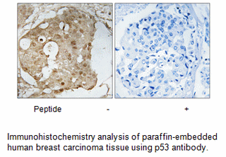 Product image for p53 (Ab-366) Antibody