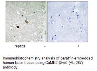 Product image for CaMK2-&beta;/&gamma;/&delta; (Ab-287) Antibody