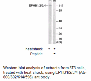 Product image for EPHB1/2/3/4 (Ab-600/602/614/596) Antibody