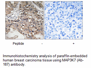 Product image for MAP3K7 (Ab-187) Antibody