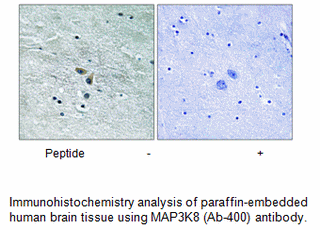 Product image for MAP3K8 (Ab-400) Antibody